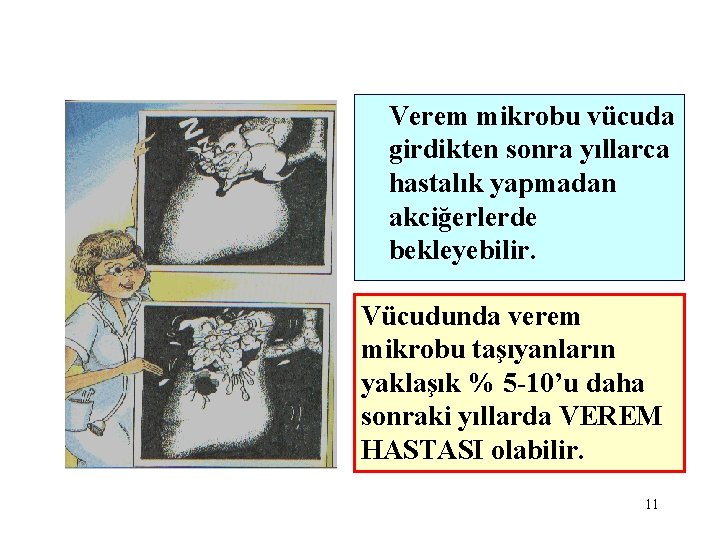 Verem mikrobu vücuda girdikten sonra yıllarca hastalık yapmadan akciğerlerde bekleyebilir. Vücudunda verem mikrobu taşıyanların