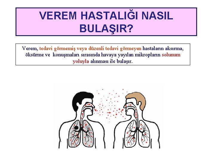 VEREM HASTALIĞI NASIL BULAŞIR? Verem, tedavi görmemiş veya düzenli tedavi görmeyen hastaların aksırma, öksürme