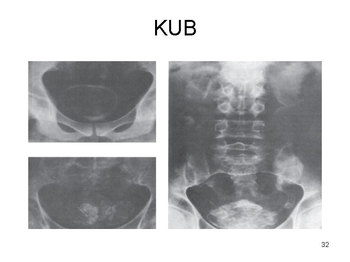 KUB 32 