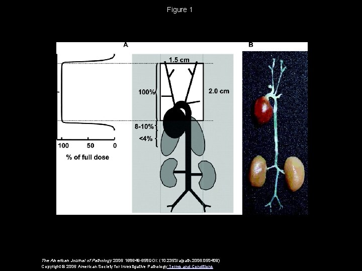 Figure 1 The American Journal of Pathology 2006 168649 -658 DOI: (10. 2353/ajpath. 2006.