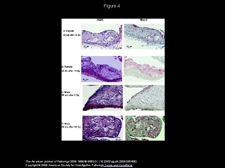 Figure 4 The American Journal of Pathology 2006 168649 -658 DOI: (10. 2353/ajpath. 2006.