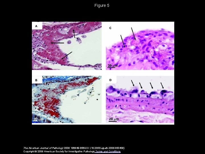 Figure 5 The American Journal of Pathology 2006 168649 -658 DOI: (10. 2353/ajpath. 2006.