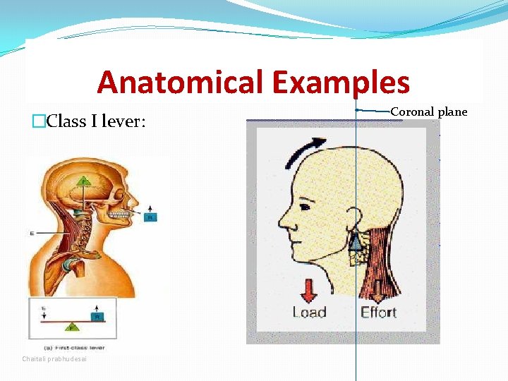 Anatomical Examples �Class I lever: Chaitali prabhudesai Coronal plane Anatomical Examples �Class I lever: Chaitali prabhudesai Coronal plane