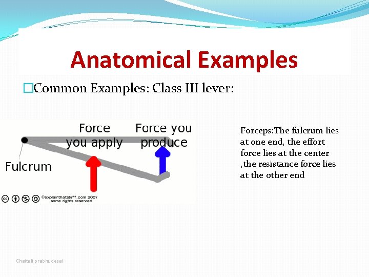 Anatomical Examples �Common Examples: Class III lever: Forceps: The fulcrum lies at one end, Anatomical Examples �Common Examples: Class III lever: Forceps: The fulcrum lies at one end,