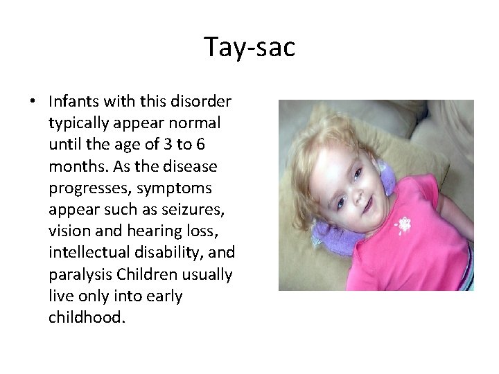 Tay-sac • Infants with this disorder typically appear normal until the age of 3