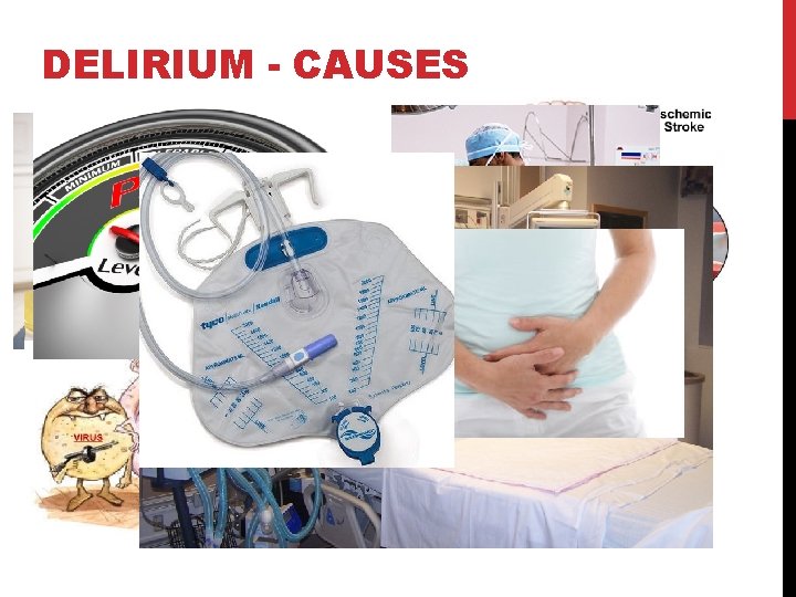 DELIRIUM - CAUSES DELIRIUM - CAUSES