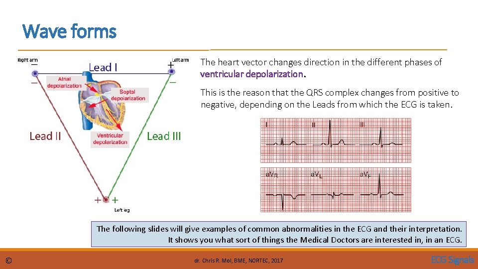 Wave forms The heart vector changes direction in the different phases of ventricular depolarization.