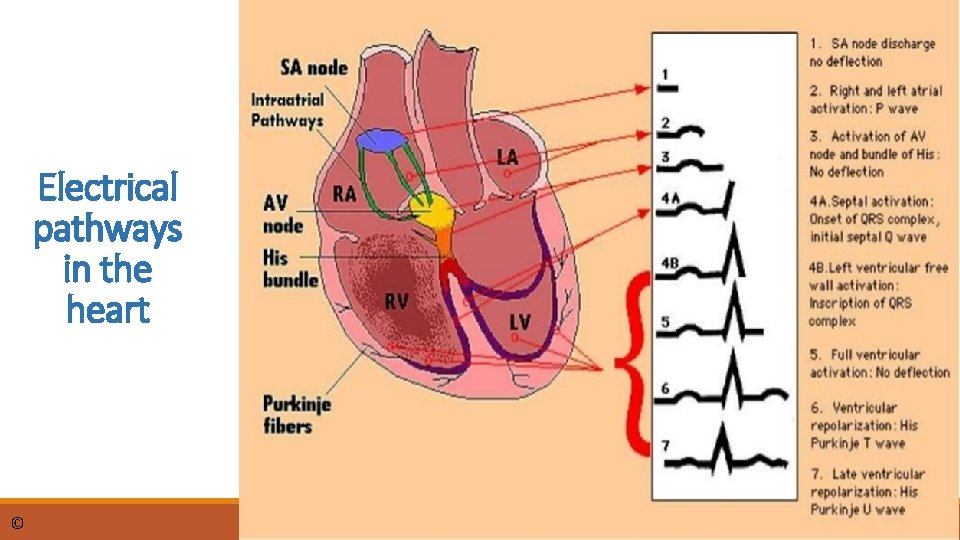 Electrical pathways in the heart © dr. Chris R. Mol, BME, NORTEC, 2015 ECG