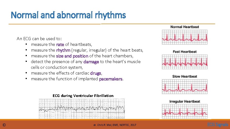 Normal and abnormal rhythms An ECG can be used to: • measure the rate