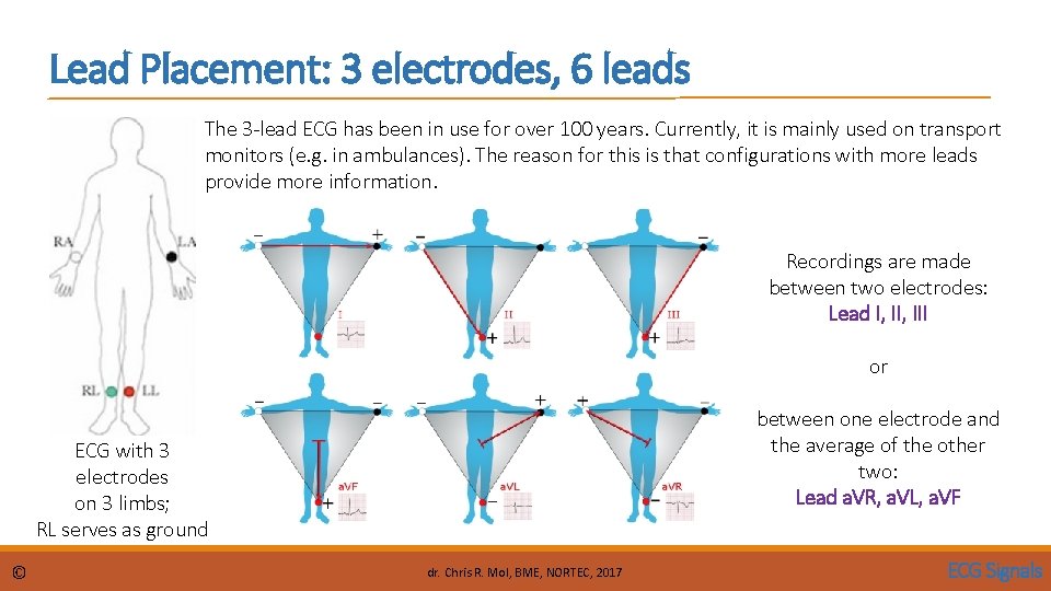 Lead Placement: 3 electrodes, 6 leads The 3 -lead ECG has been in use