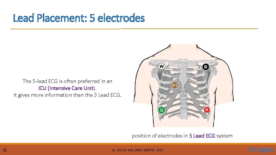 Lead Placement: 5 electrodes The 5 -lead ECG is often preferred in an ICU