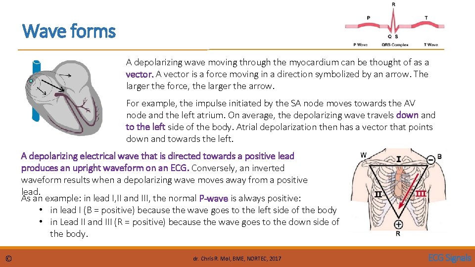 Wave forms A depolarizing wave moving through the myocardium can be thought of as