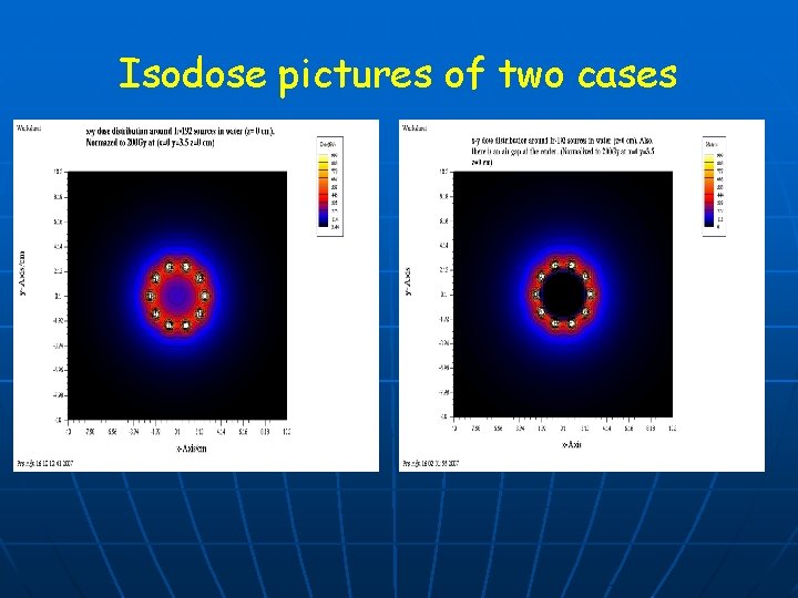 Isodose pictures of two cases 