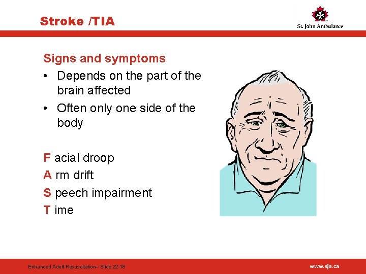 Stroke /TIA Signs and symptoms • Depends on the part of the brain affected