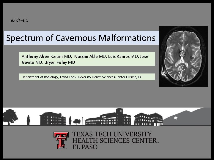 e. Ed. E-60 Spectrum of Cavernous Malformations Anthony Abou Karam MD, Nassim Akle MD,