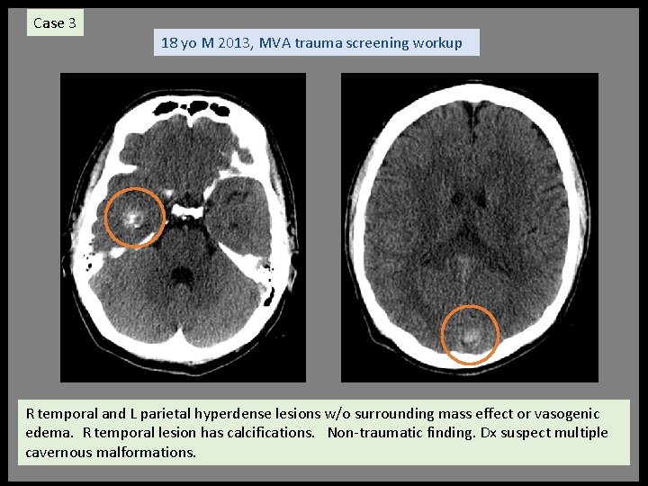 Case 3 18 yo M 2013, MVA trauma screening workup R temporal and L