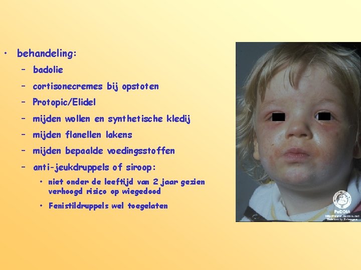  • behandeling: – badolie – cortisonecremes bij opstoten – Protopic/Elidel – mijden wollen