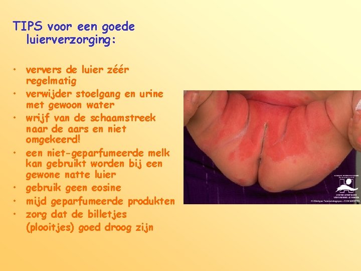 TIPS voor een goede luierverzorging: • ververs de luier zéér regelmatig • verwijder stoelgang