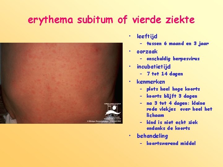 erythema subitum of vierde ziekte • leeftijd • oorzaak • incubatietijd • kenmerken •