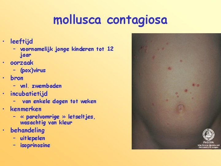 mollusca contagiosa • leeftijd – voornamelijk jonge kinderen tot 12 jaar • oorzaak –