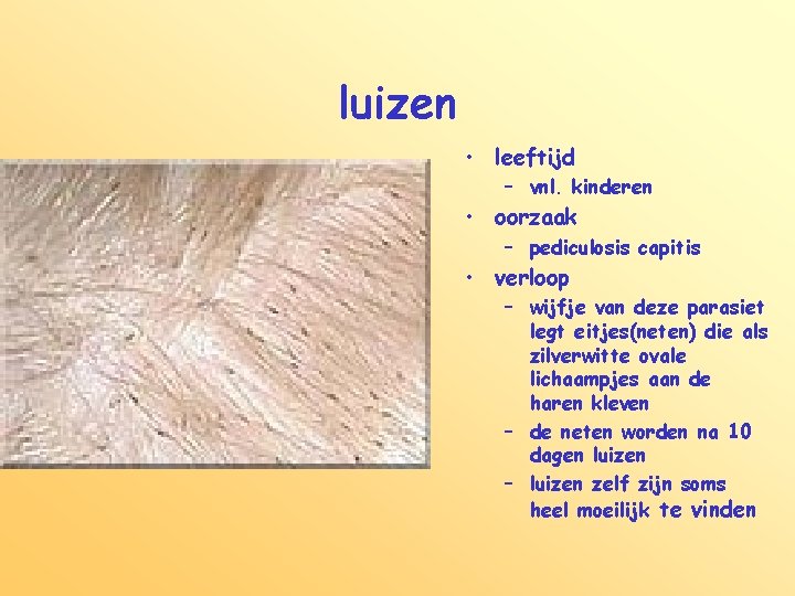 luizen • leeftijd – vnl. kinderen • oorzaak – pediculosis capitis • verloop –