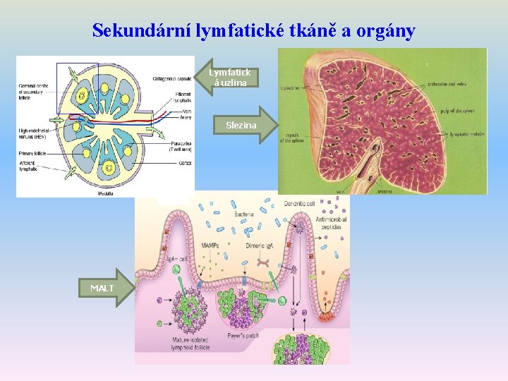 Sekundární lymfatické tkáně a orgány Lymfatick á uzlina Slezina MALT 