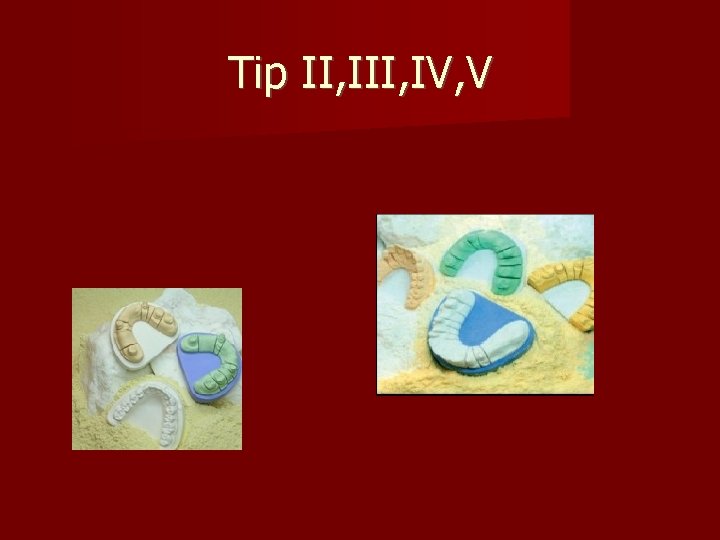 Tip II, IV, V 