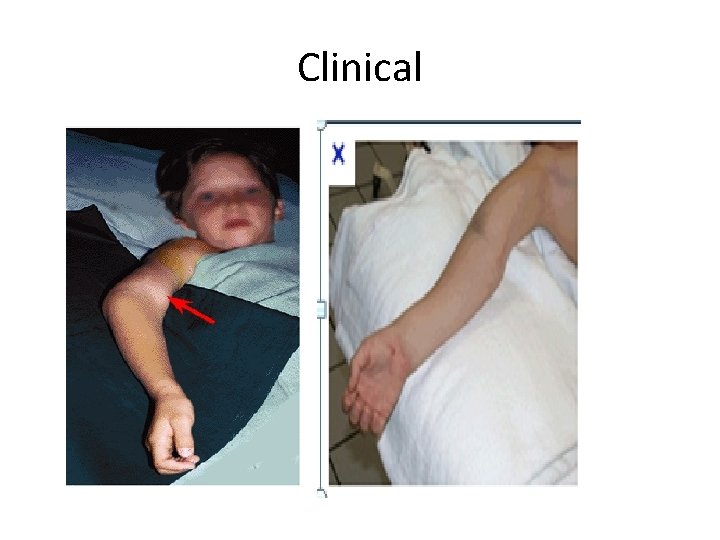 Clinical Clinical