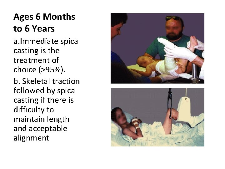 Ages 6 Months to 6 Years a. Immediate spica casting is the treatment of Ages 6 Months to 6 Years a. Immediate spica casting is the treatment of