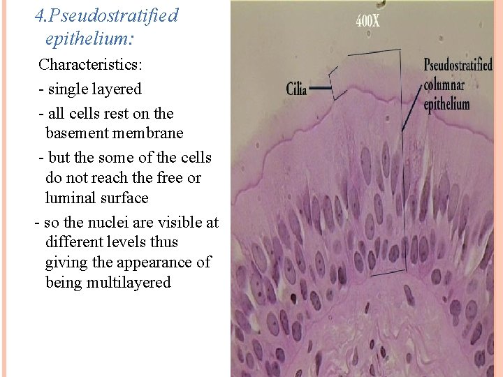 4. Pseudostratified epithelium: Characteristics: - single layered - all cells rest on the basement
