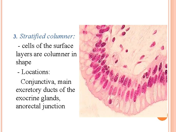 3. Stratified columner: - cells of the surface layers are columner in shape -