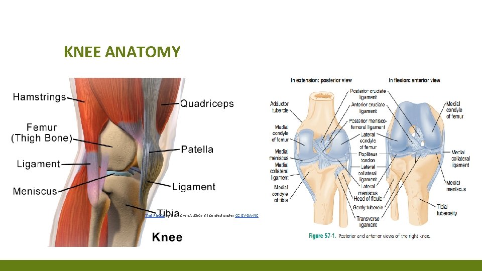 KNEE ANATOMY This Photo by Unknown Author is licensed under CC BY-SA-NC KNEE ANATOMY This Photo by Unknown Author is licensed under CC BY-SA-NC