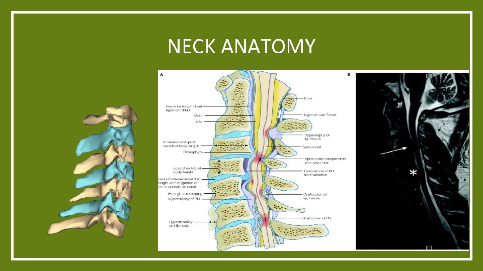 NECK ANATOMY This Photo by Unknown Author is licensed under CC BYSA This Photo NECK ANATOMY This Photo by Unknown Author is licensed under CC BYSA This Photo