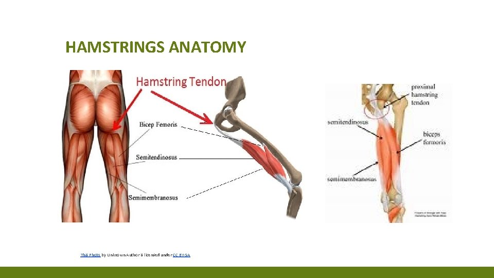 HAMSTRINGS ANATOMY This Photo by Unknown Author is licensed under CC BY-SA INJURY HAMSTRINGS ANATOMY This Photo by Unknown Author is licensed under CC BY-SA INJURY