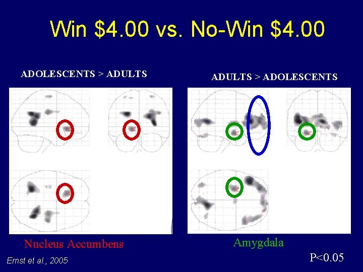 Win $4. 00 vs. No-Win $4. 00 ADOLESCENTS > ADULTS Nucleus Accumbens Ernst et