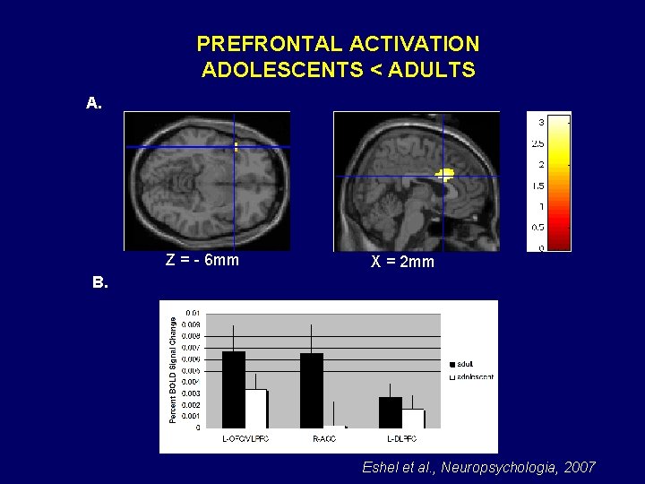 PREFRONTAL ACTIVATION ADOLESCENTS < ADULTS A. Z = - 6 mm X = 2