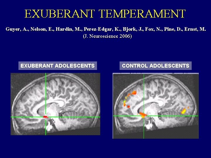 EXUBERANT TEMPERAMENT Guyer, A. , Nelson, E. , Hardin, M. , Perez-Edgar, K. ,