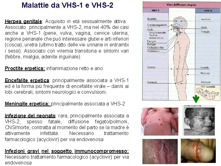 Malattie da VHS-1 e VHS-2 Herpes genitale: Acquisito in età sessualmente attiva. Associato principalmente