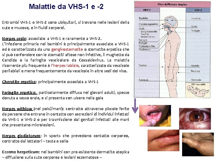 Malattie da VHS-1 e -2 Entrambi VHS-1 e VHS-2 sono ubiquitari, si trovano nelle