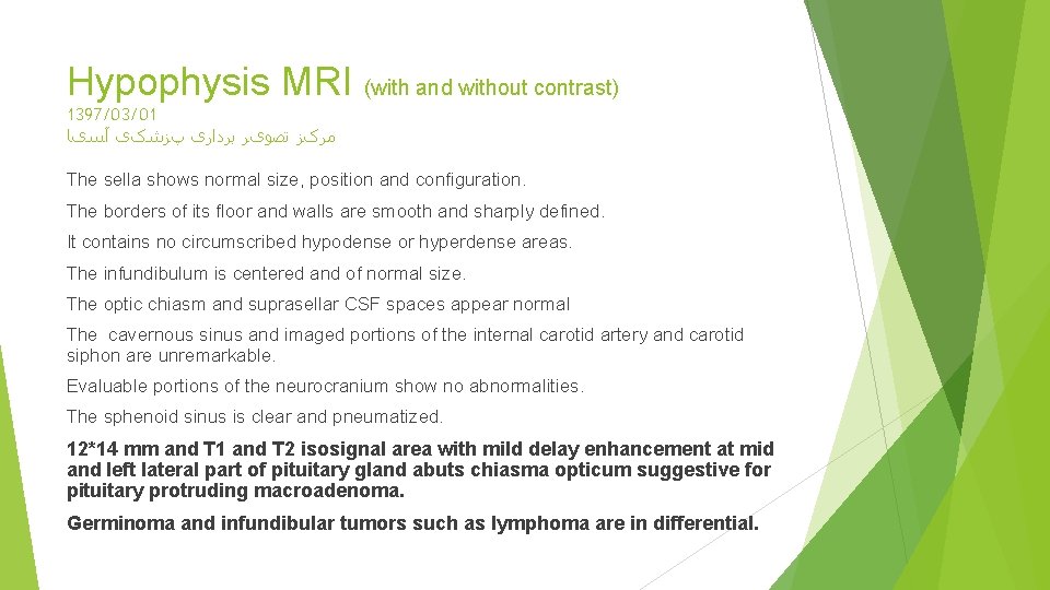 Hypophysis MRI (with and without contrast) 1397/03/01 ﻣﺮکﺰ ﺗﺼﻮیﺮ ﺑﺮﺩﺍﺭی پﺰﺷکی آﺴیﺎ The sella