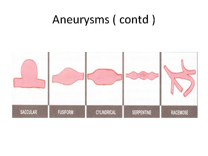 Aneurysms ( contd ) 