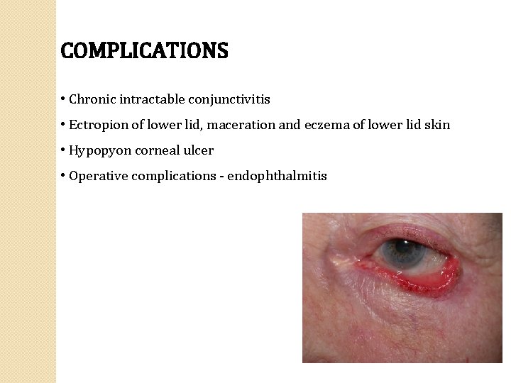 COMPLICATIONS • Chronic intractable conjunctivitis • Ectropion of lower lid, maceration and eczema of