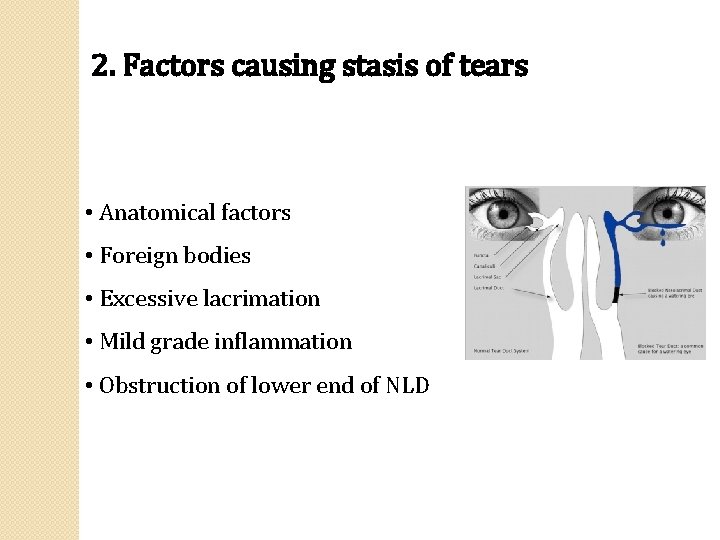 2. Factors causing stasis of tears • Anatomical factors • Foreign bodies • Excessive