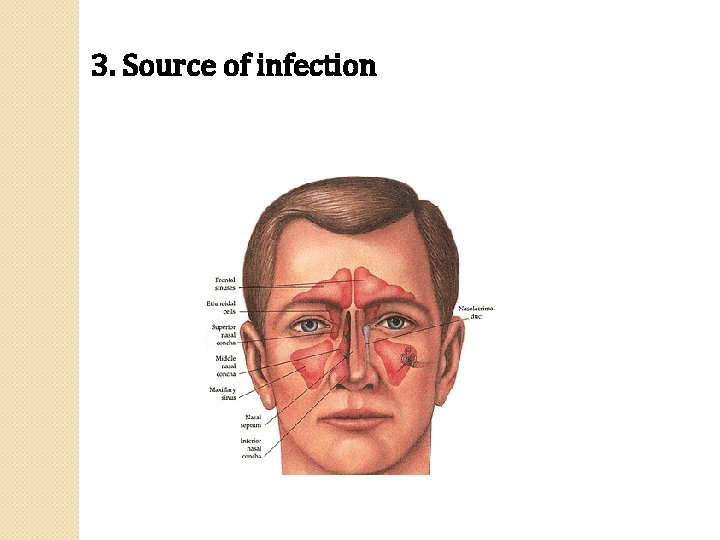 3. Source of infection 