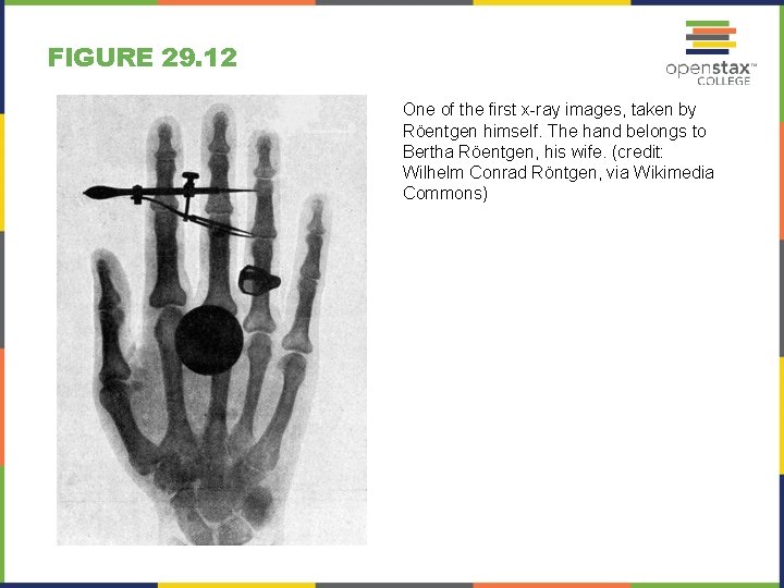 FIGURE 29. 12 One of the first x-ray images, taken by Röentgen himself. The