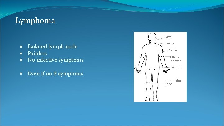 Lymphoma ● Isolated lymph node ● Painless ● No infective symptoms ● Even if