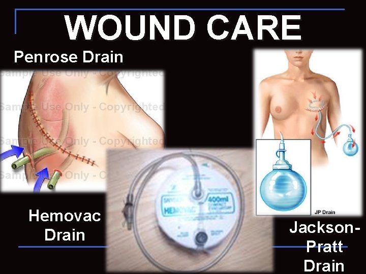 WOUND CARE Penrose Drain Hemovac Drain Jackson. Pratt Drain 