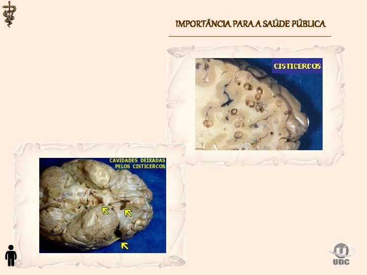 IMPORT NCIA PARA A SAÚDE PÚBLICA 