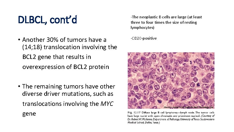 DLBCL, cont’d -The neoplastic B cells are large (at least three to four times DLBCL, cont’d -The neoplastic B cells are large (at least three to four times