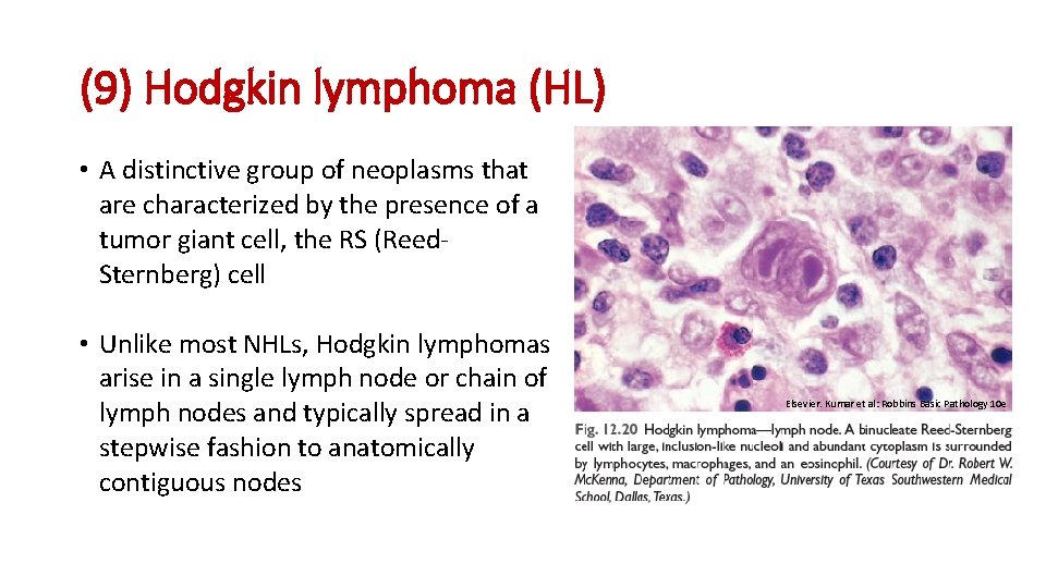 (9) Hodgkin lymphoma (HL) • A distinctive group of neoplasms that are characterized by (9) Hodgkin lymphoma (HL) • A distinctive group of neoplasms that are characterized by